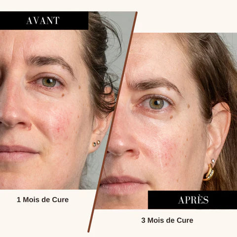 Résultats avant/après cure collagène ETERNA GLOW – peau éclatante et ferme, beauté naturelle visible.